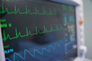 Image of a heart monitor showing abnormal vital signs in the emergency department. 